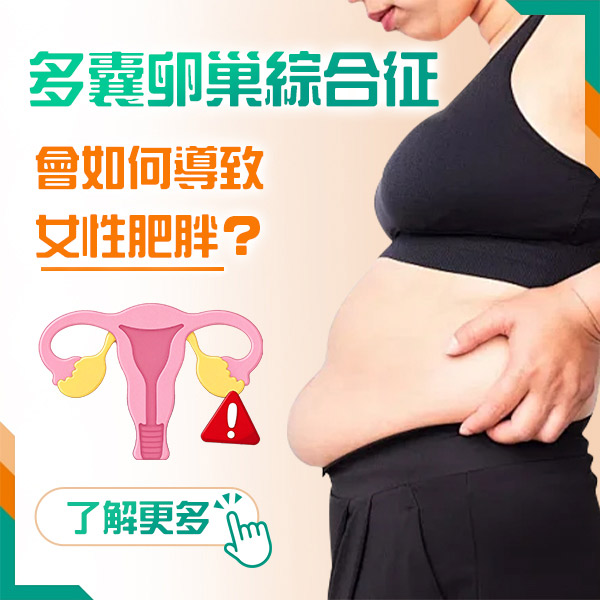 37539709.jpg 多囊卵巢.jpg